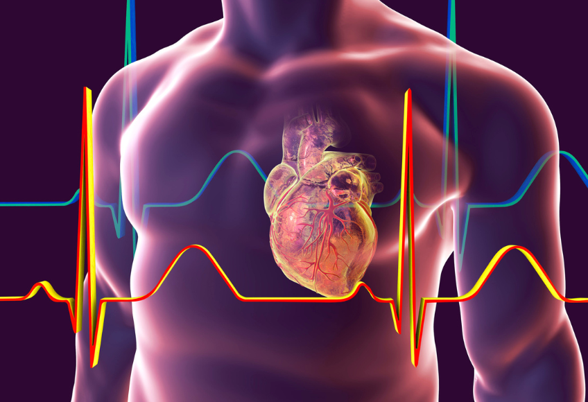 Heart racing and histamine intolerance