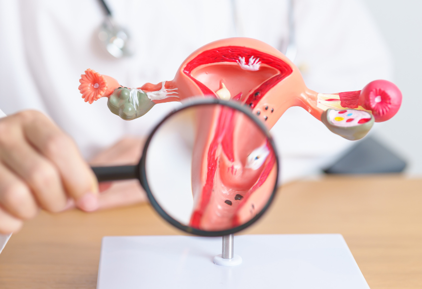 Endometriosis and histamine intolerance