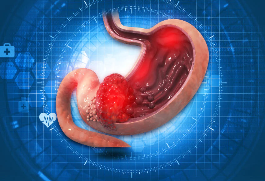 Organ series: stomach