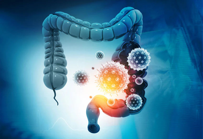 The leaky intestine - the leaky good syndrome