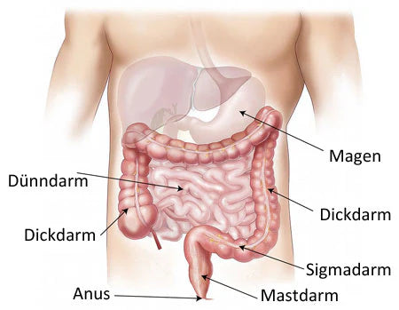 Darmsanierung