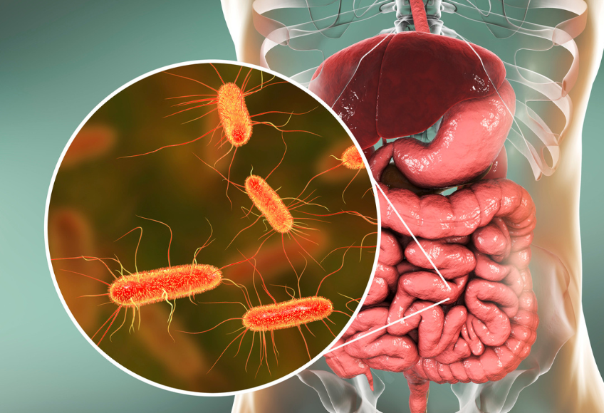 Darmcheck oder Microbiomuntersuchung?